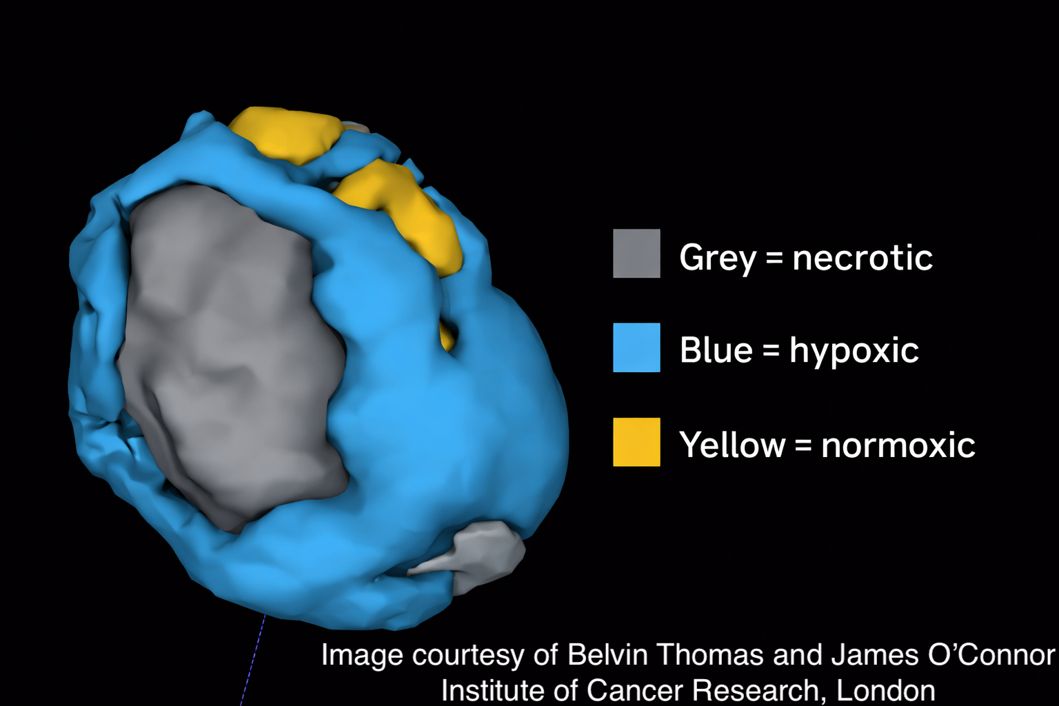 Tumour hypoxia imaging example
