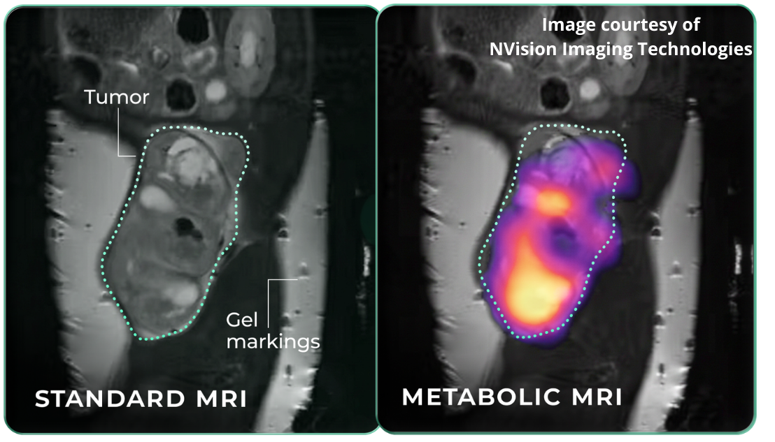 NVision hyperpolarized metabolic MRI imaging examples