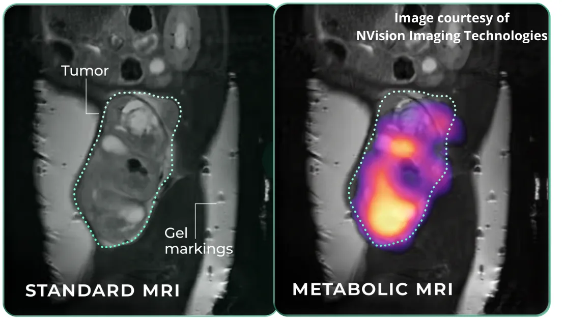NVision hyperpolarized metabolic MRI imaging examples