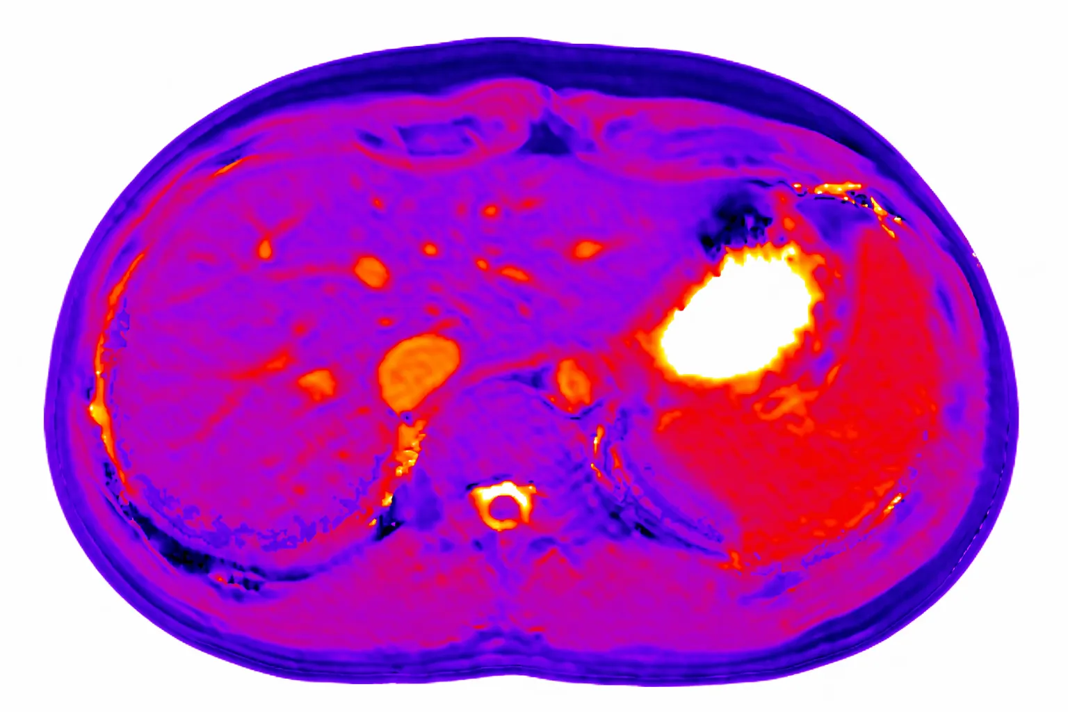 Liver transporter imaging